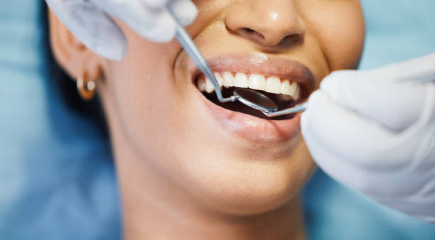 Best Broken or Chipped Tooth Repair in Elgin, IL